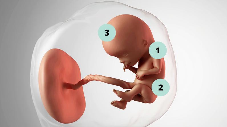 1. A pele do feto é tão fininha que chega a ser transparente, mostrando as veias do sistema circulatório; 2. Os rins passam a produzir o xixi; 3. No ultrassom, é possível visualizar algumas estruturas do cérebro — Foto: Getty Images