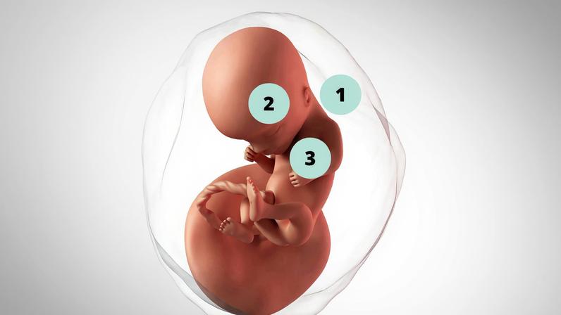 1. Cabeça do bebê passa a ficar mais separada do restante do corpo, evidenciando ainda mais o pescoço; 2. Os olhos fazem movimentos lentos; 3. É possível ouvir o coração do bebê usando um monitor fetal, que funciona por doppler — Foto: Getty Images