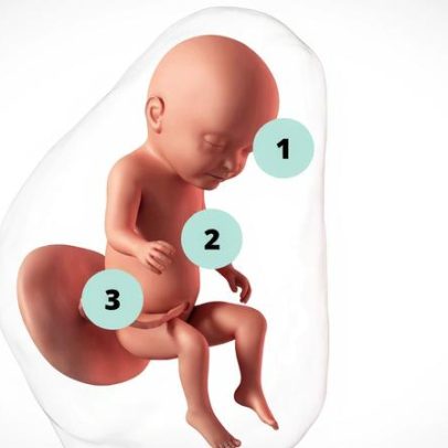 Gravidez de 30 semanas: acompanhamento médico continua
