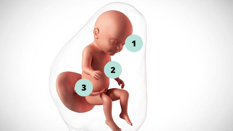 Os glóbulos vermelhos estão se formando na medula óssea do bebê, que segue se desenvolvendo a todo vapor.