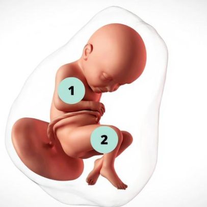 Gravidez de 32 semanas: informações e cuidados recomendados