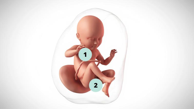 1. O vérnix caseoso engrossa e, em breve, ajudará na passagem do bebê pelo canal vaginal, durante o parto normal; 2. Em bebês meninos, ocorre a descida dos testículos do abdome para o saco escrotal — Foto: Getty Images