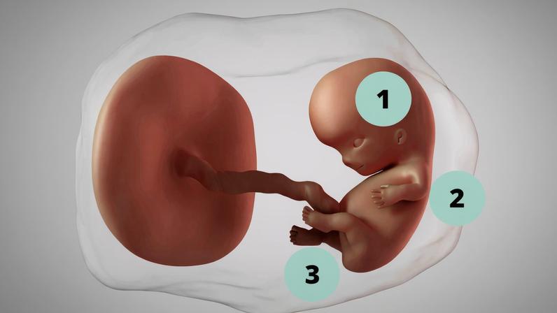 O embrião de 9 semanas mede cerca de 2,5 centímetros, tamanho semelhante ao de um brigadeiro. Estão em formação órgãos como coração e rins e também partes do corpo como pálpebras, cotovelos e língua. Os hormônios da gravidez podem causar náusea e dor de cabeça na gestante. Saiba mais sobre a 9ª semana de gravidez.