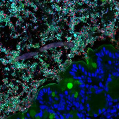 Competição de bactérias intestinais impede que patógenos causem doenças