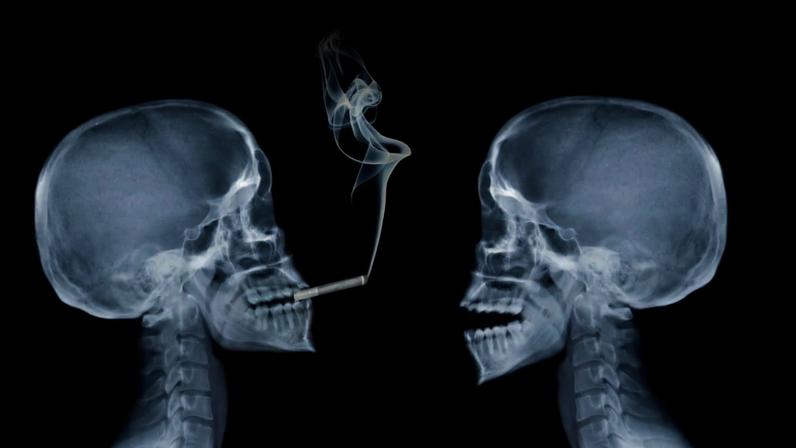 Image of two skeletons in X-ray, one is smoking.