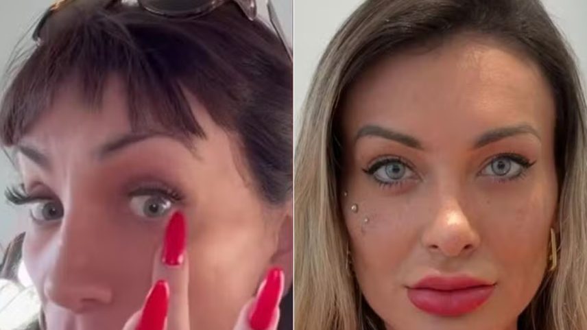 Maya Massafera e Andressa Urach após procedimento de mudança da cor de olhos (Foto: Reprodução/ Redes Sociais)