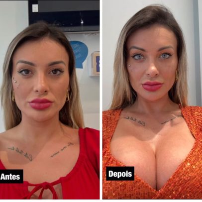 Urach revela temor de cegueira após mudança na cor dos olhos e alerta sobre riscos