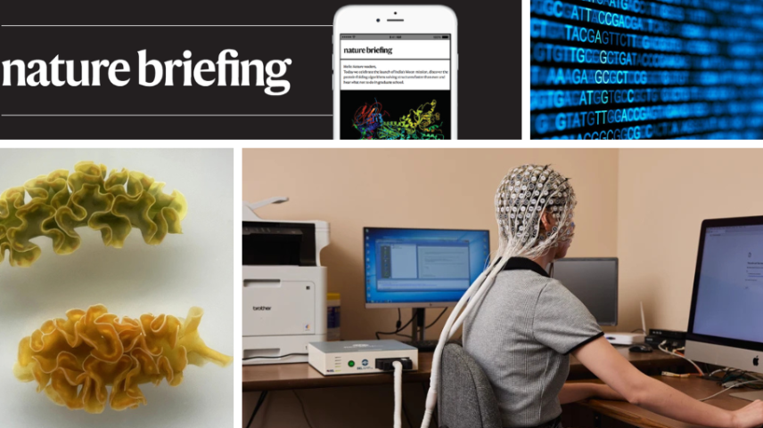 A eletroencefalografia pode ser usada para estudar a atividade cerebral enquanto as pessoas realizam tarefas com e sem a ajuda de chatbots como o ChatGPT. (Foto: Leah Nash/Washington Post/Getty)