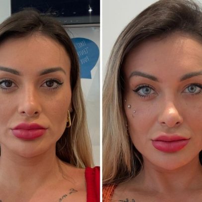 Andressa Urach realiza cirurgia de queratopigmentação para mudar a cor dos olhos