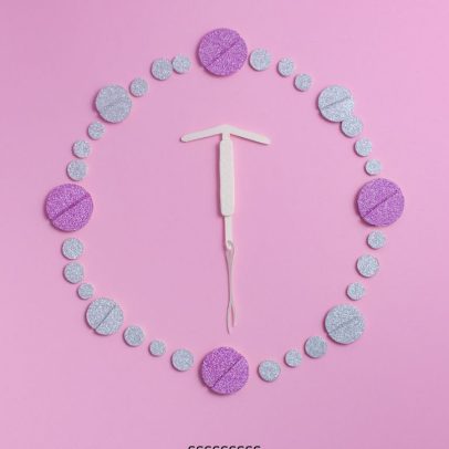 DIU hormonal é disponibilizado como tratamento no SUS para mulheres brasileiras