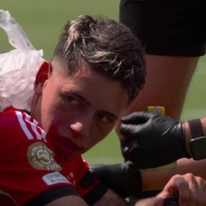 Jogador do Benfica desmaia devido ao calor e é socorrido durante partida