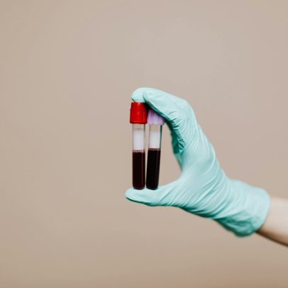 Cientistas revelam os surpreendentes benefícios do sangue tipo O para a saúde