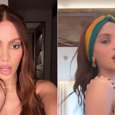 Anitta comenta mudanças no rosto e revela procedimentos estéticos realizados