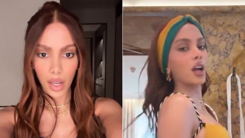 A cantora Anitta, após novo procedimento estético no rosto (Foto: Reprodução/X)