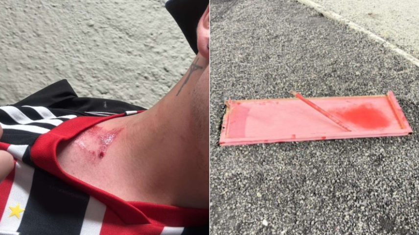 Torcedor reclama do tratamento dado pelo clube após o incidente (Foto: Reprodução)