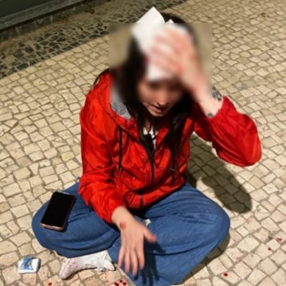 Brasileira é agredida com pedrada na cabeça durante caminhada em Portugal