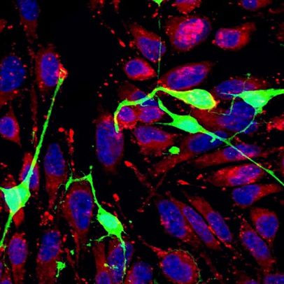Células cancerígenas aumentam metástase ao roubar mitocôndrias de nervos