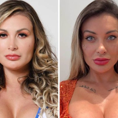 Andressa Urach expressa arrependimento por cirurgia para mudar a cor dos olhos