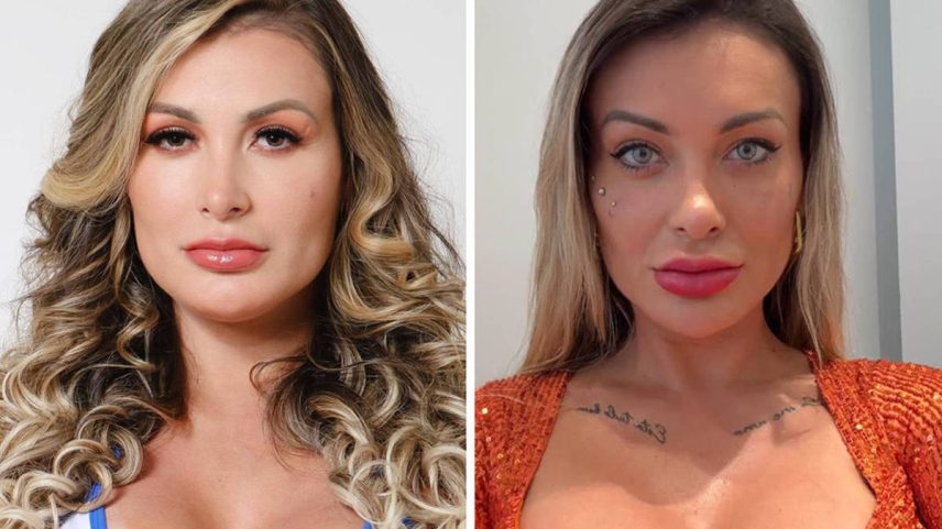 Andressa Urach revela complicações após cirurgia para mudar a cor dos olhos (Foto: Instagram)