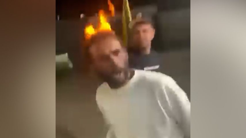 Jovens ateiam fogo na cabeça de morador de rua em Piraquara (PR) (Foto: Reprodução)