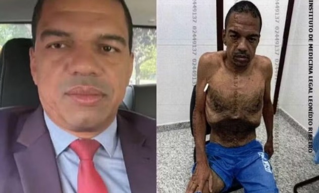 Imagem consta no processo em que o lobista pediu para deixar a prisão, diante de sua grave condição de saúde (Foto: Reprodução)
