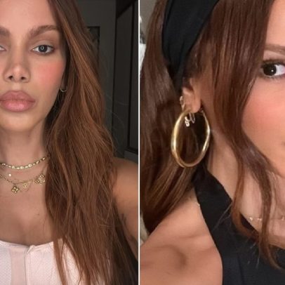 Anitta enfrenta desafios após cirurgia plástica inspirada em Michael Jackson