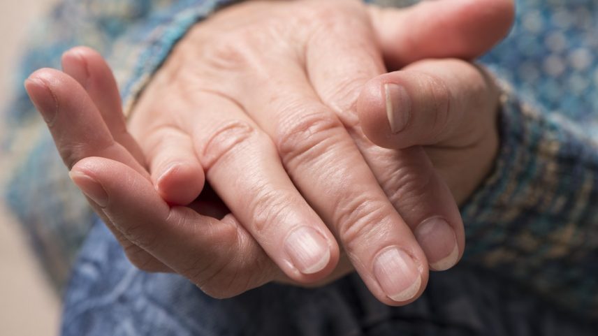 Unhas estriadas: o que são, por que aparecem e quando se preocupar (Foto: Getty Images)