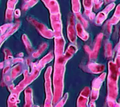 Fungos mortais se proliferam e ameaçam a saúde global com novas infecções