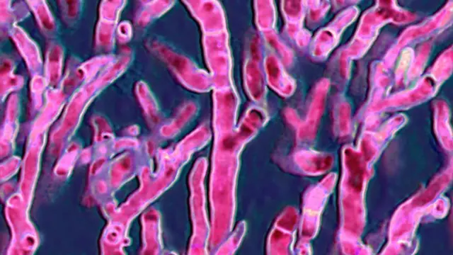 Fungo responsável por graves infecções em aves e seres humanos, como aspergilose bronquiopulmonar e aspergiloma (Foto: BSIP/Education Images/Universal Images Group/Getty Images)