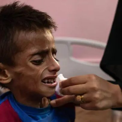 Fome extrema em Gaza provoca crise humanitária e sofrimento sem precedentes