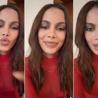 Anitta fala sobre procedimentos faciais e seu impacto na carreira musical