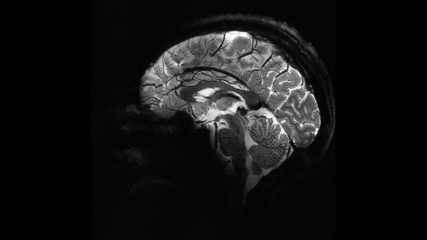 Imagem do Iseult Magneton 11.7 T MRI mostra cérebro humano. (Foto: Divulgação / Comissão de Energia Atômica da França (CEA))