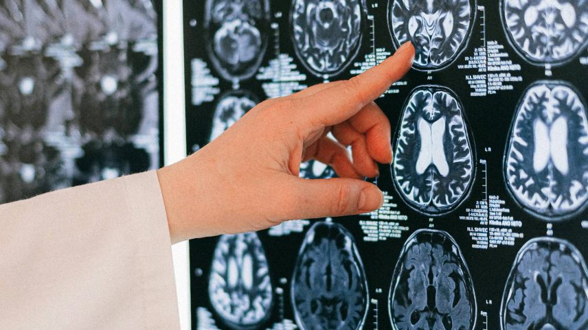 A associação entre diferenças em estruturas cerebrais e psicopatia é real, mas não é necessariamente determinista para o desenvolvimento do transtorno (Foto: Anna Shvets/Pexels)