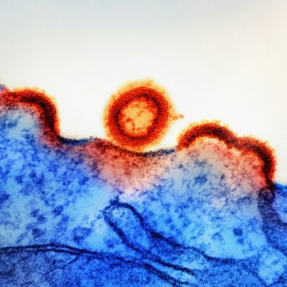 Cientistas descobrem tratamento inédito para prevenir o HTLV-1, vírus semelhante ao HIV