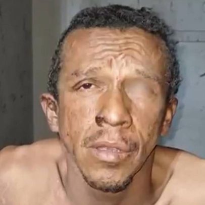 Polícia detém morador de rua suspeito de homicídio e agressão em São Paulo