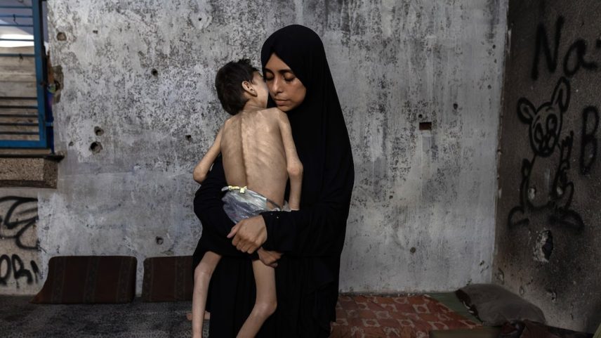 Samah Matar segura seu filho Yousef, de 6 anos, ao norte da Cidade de Gaza, na quinta-feira, 24 de julho de 2025. Yousef tem paralisia cerebral e desnutrição grave. Ele pesava cerca de 13 quilos antes da guerra, mas agora pesa cerca de 9 quilos. (Foto: Saher Alghorra/NYT)