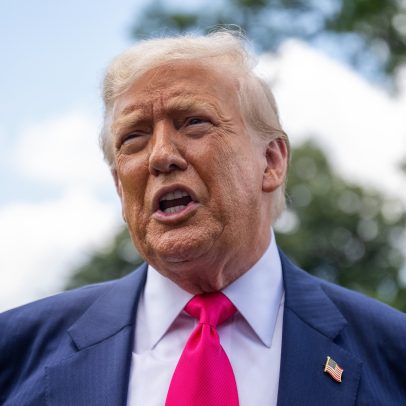 Trump é diagnosticado com insuficiência venosa crônica após inchaço nos tornozelos