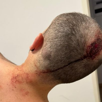 Homem relata ameaça de tiro e fuga em situação de risco iminente