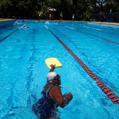 Exercícios aquáticos aceleram recuperação após cirurgias; saiba como funciona