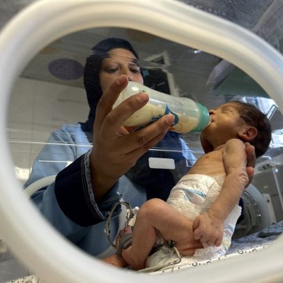 Bebês de Gaza enfrentam fome sem leite em fórmula disponível