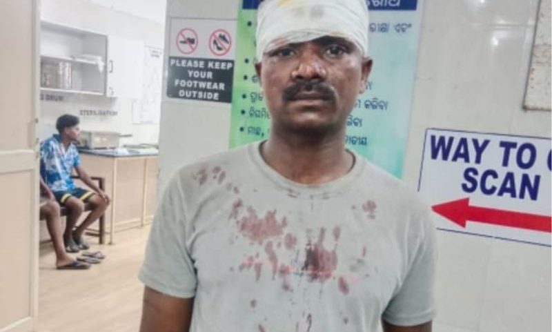Cristão ferido durante os ataques promovidos por nacionalistas hindus. (Foto: Reprodução/ICC)
