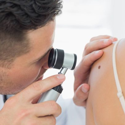 90 milhões de brasileiros não realizaram consulta dermatológica, revela Datafolha