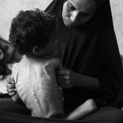 Guerra em Gaza exige fim imediato da violência e proteção à população civil