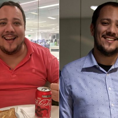 Jornalista relata perda de 45 kg em um ano após cirurgia bariátrica