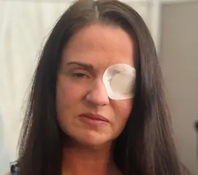 Mulher tem parada cardíaca e quase fica cega após aplicação de botox falsificado