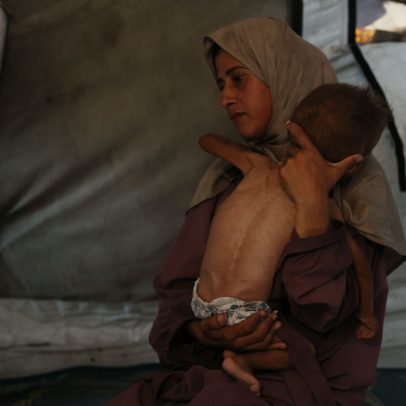 Desnutrição em Gaza atinge níveis alarmantes, alerta OMS sobre crise humanitária