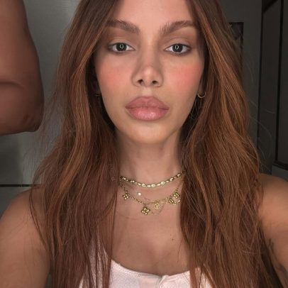Anitta revela novos procedimentos estéticos com a ajuda de especialistas
