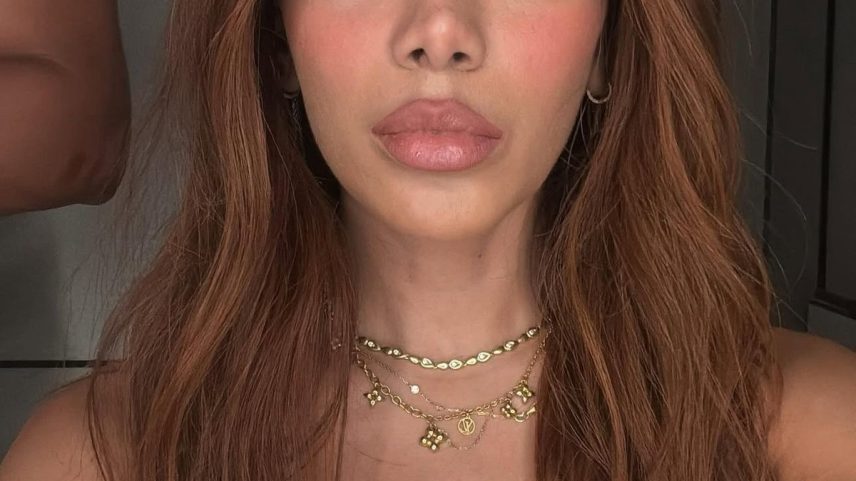 O novo rosto de Anitta (Foto: Reprodução/Instagram)