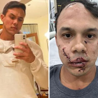 Suspeito de agredir personal e causar 45 pontos no rosto é identificado pela polícia