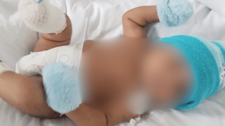 Heitor teve o pé amputado após falha de acesso intravenoso (Foto: Cedido ao UOL)
